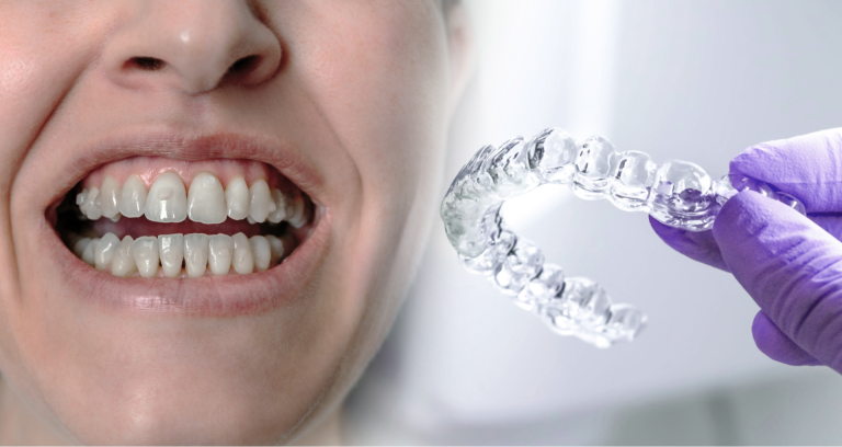 Achieving a Perfect Smile with Invisalign: Insights from Sydney's Top Clinics